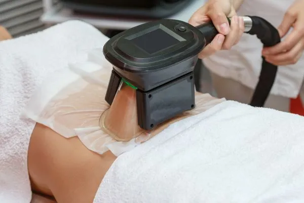 Image of person having fat freezing treatment to help weight gain Bridport