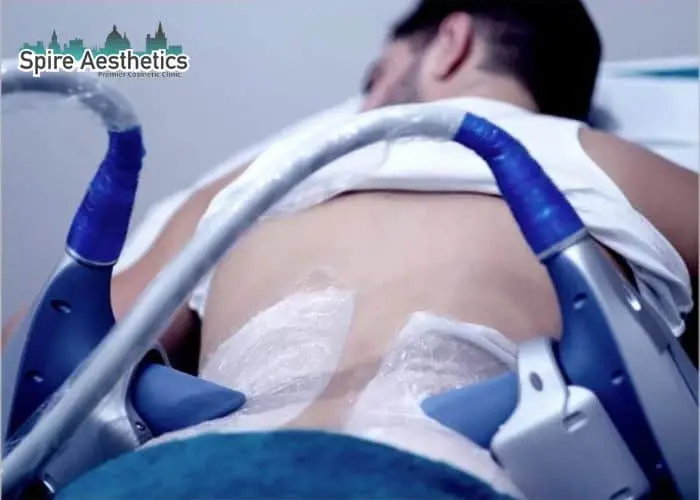 Man having fat freezing treatment done on love handles before a competitions Bridport to create a sculpted look.